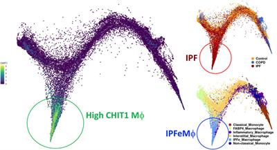 Targeting Chitinase 1 and Chitinase 3-Like 1 as Novel Therapeutic Strategy of Pulmonary Fibrosis